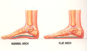 Normal and flat arches